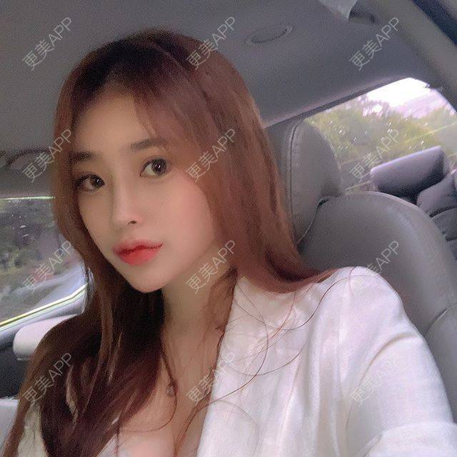 更美 - 更美用户riHIJ4id4t的嗨体淡化颈纹经验 | 嗨体淡化颈纹 | 上海