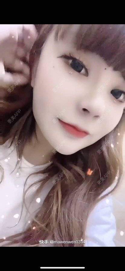 更美 - 更美用户lBnn40gnCa的热玛吉经验 | 石家庄 | 热玛吉