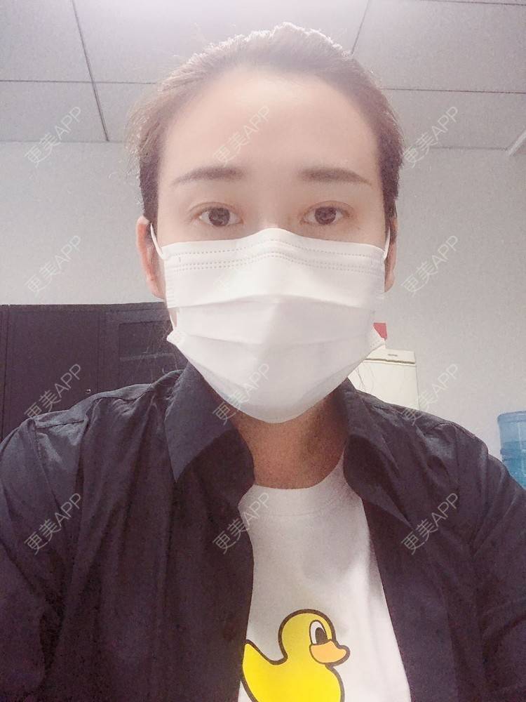 更美 - 更美用户ATliTAq8jn的内切去眼袋经验 | 北京 | 眶隔脂肪释放 | 射频去眼袋 | 内切去眼袋 | 激光去眼袋