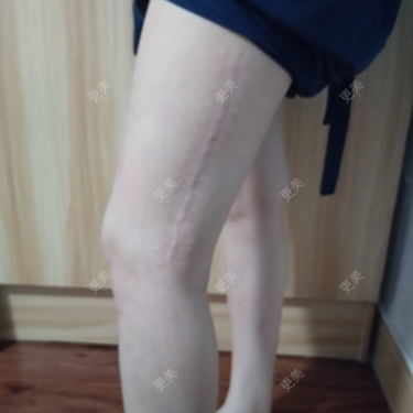 更美用户wLCOFKdytM