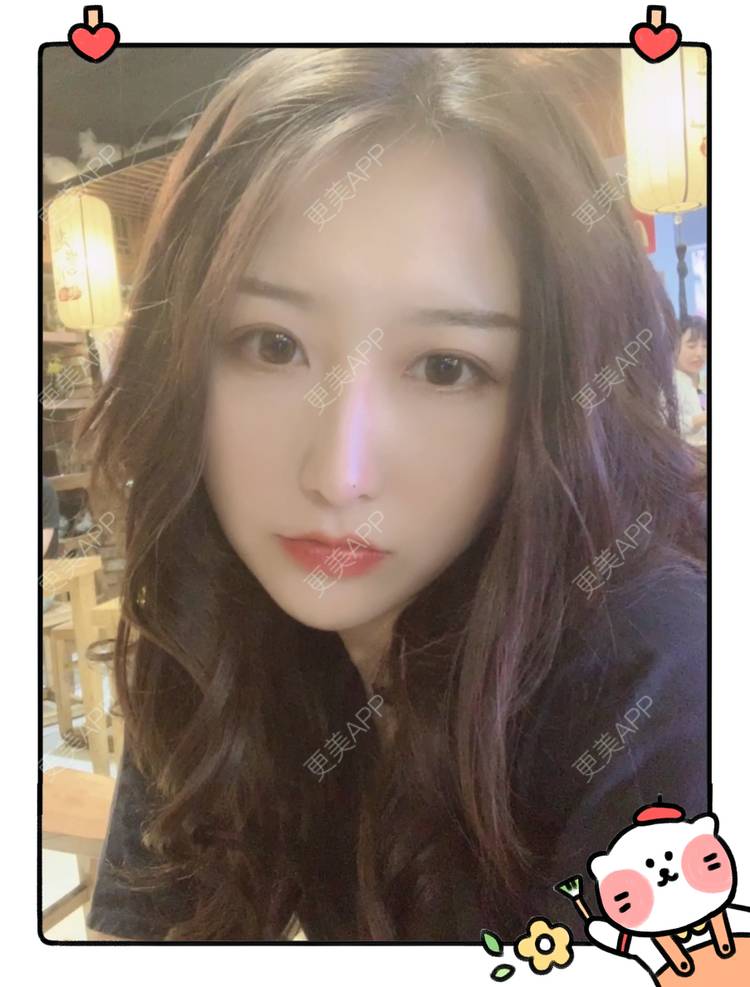 更美 - 更美用户C5Srbgl5fF的玻尿酸经验 | 玻尿酸套餐 | 玻尿酸 | 深圳