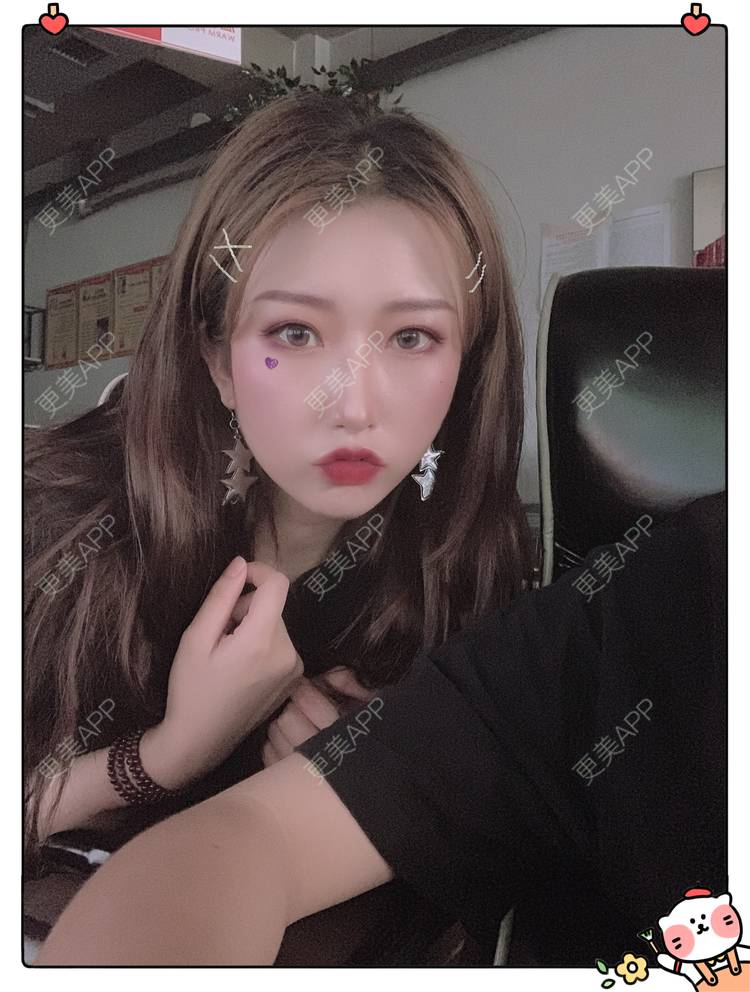 更美 - 更美用户C5Srbgl5fF的玻尿酸经验 | 玻尿酸套餐 | 玻尿酸 | 深圳
