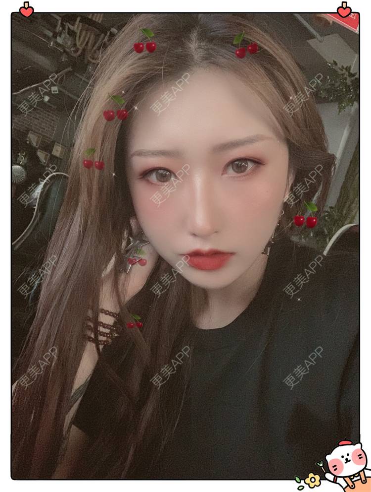 更美 - 更美用户C5Srbgl5fF的玻尿酸经验 | 玻尿酸套餐 | 玻尿酸 | 深圳