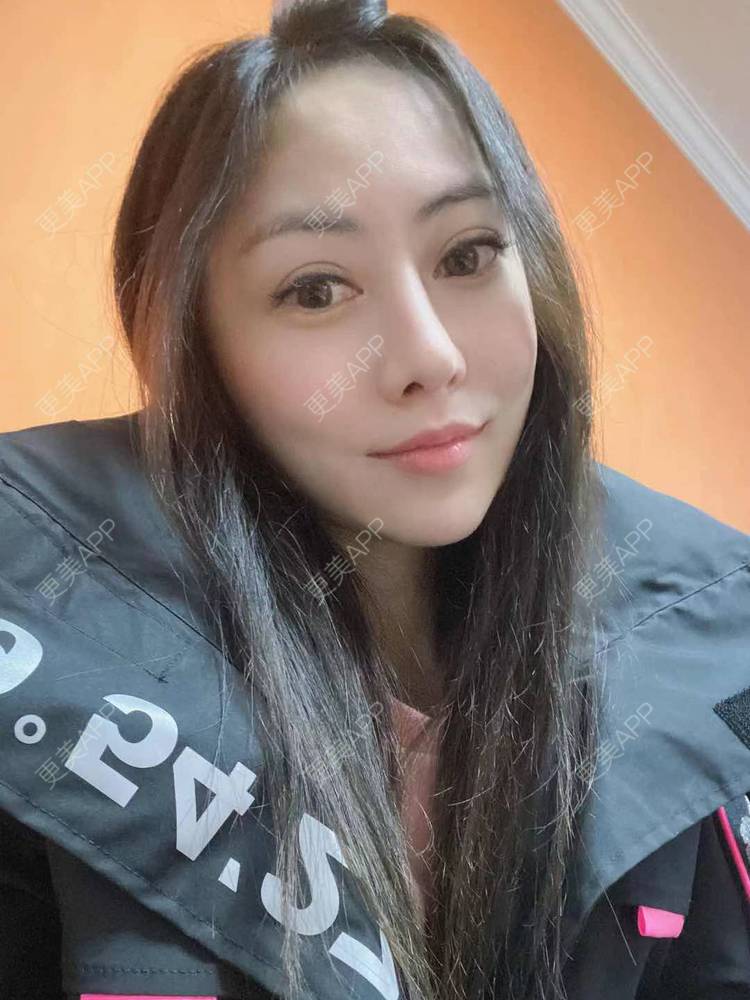 更美 - 大鱼海棠依旧的唇腭裂修复经验 | 唇腭裂修复 | 厚唇改薄 | 微笑唇手术 | 唇综合 | M唇成形