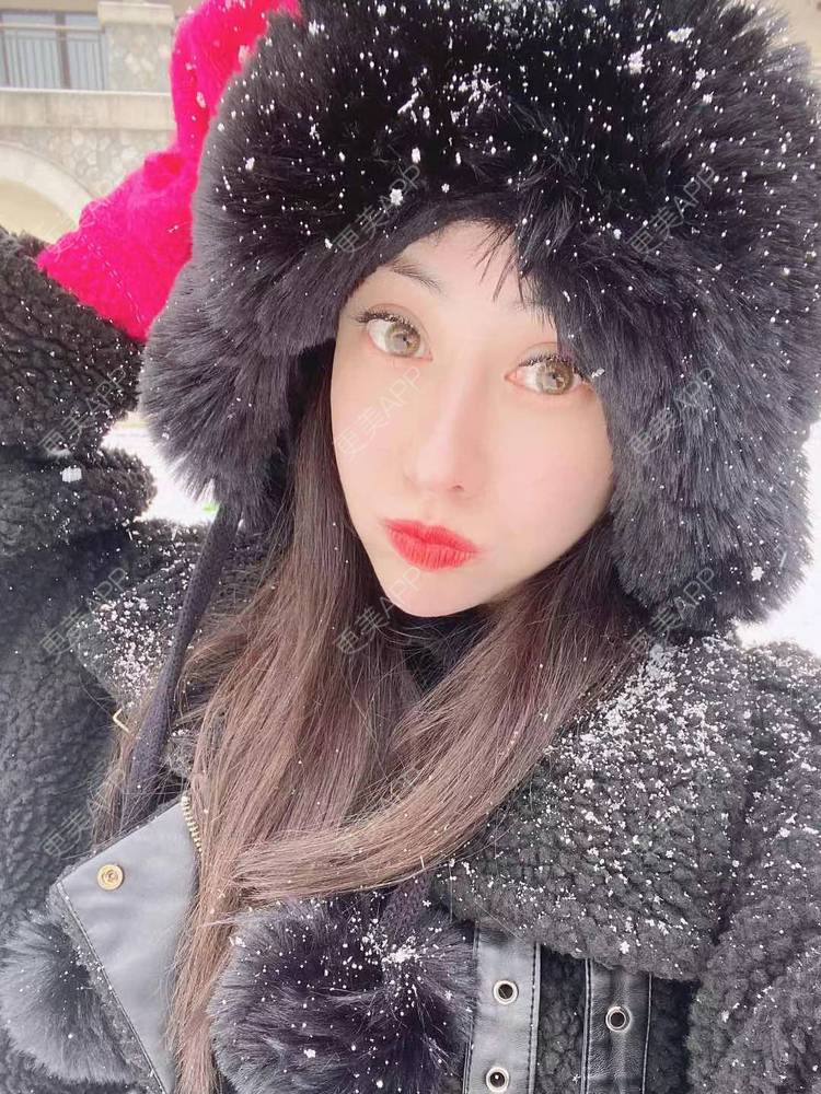 更美 - 大鱼海棠依旧的唇腭裂修复经验 | 唇腭裂修复 | 厚唇改薄 | 微笑唇手术 | 唇综合 | M唇成形