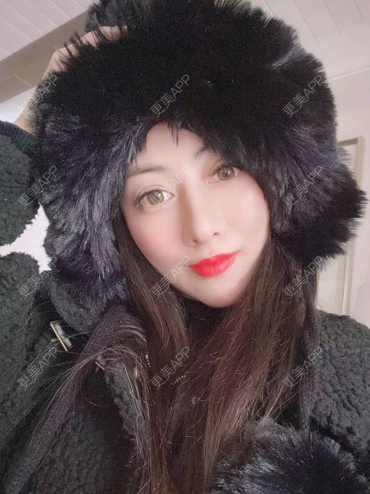 更美 - 大鱼海棠依旧的唇腭裂修复经验 | 唇腭裂修复 | 厚唇改薄 | 微笑唇手术 | 唇综合 | M唇成形