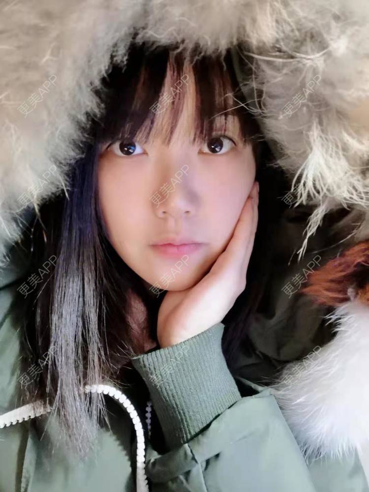 更美 - 甜心女孩不说的祛眼袋经验 | 内切去眼袋 | 外切去眼袋 | 眶隔脂肪释放 | 激光去眼袋 | 射频去眼袋 | 祛眼袋