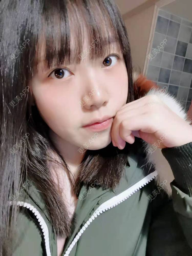更美 - 甜心女孩不说的祛眼袋经验 | 内切去眼袋 | 外切去眼袋 | 眶隔脂肪释放 | 激光去眼袋 | 射频去眼袋 | 祛眼袋
