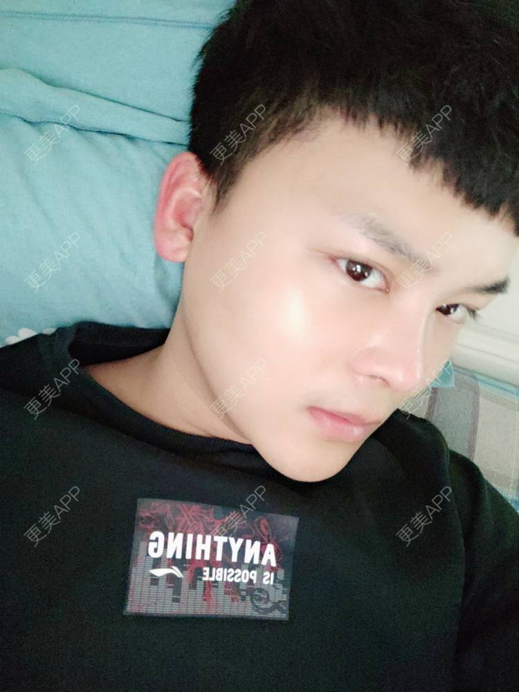更美 - Mr🐔哦啦啦的隆鼻经验 | 隆鼻 | 鼻部多项 | 重庆