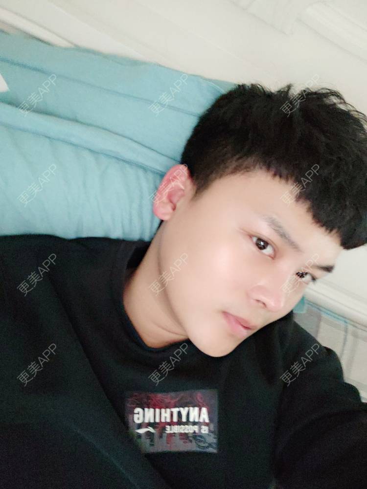 更美 - Mr🐔哦啦啦的隆鼻经验 | 隆鼻 | 鼻部多项 | 重庆