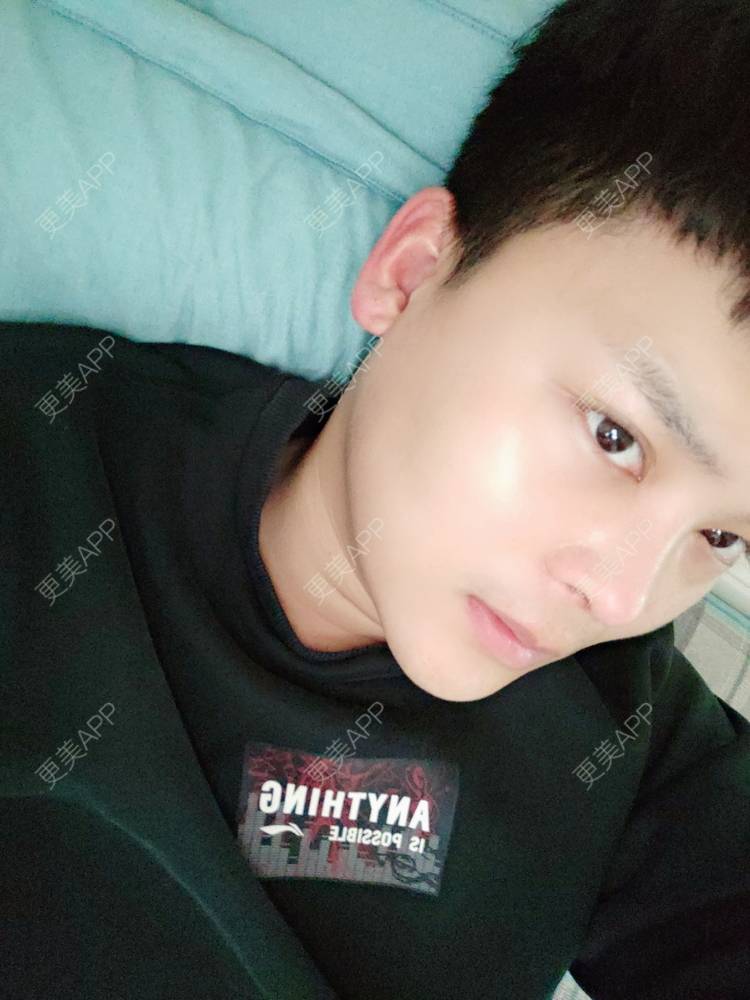 更美 - Mr🐔哦啦啦的隆鼻经验 | 隆鼻 | 鼻部多项 | 重庆