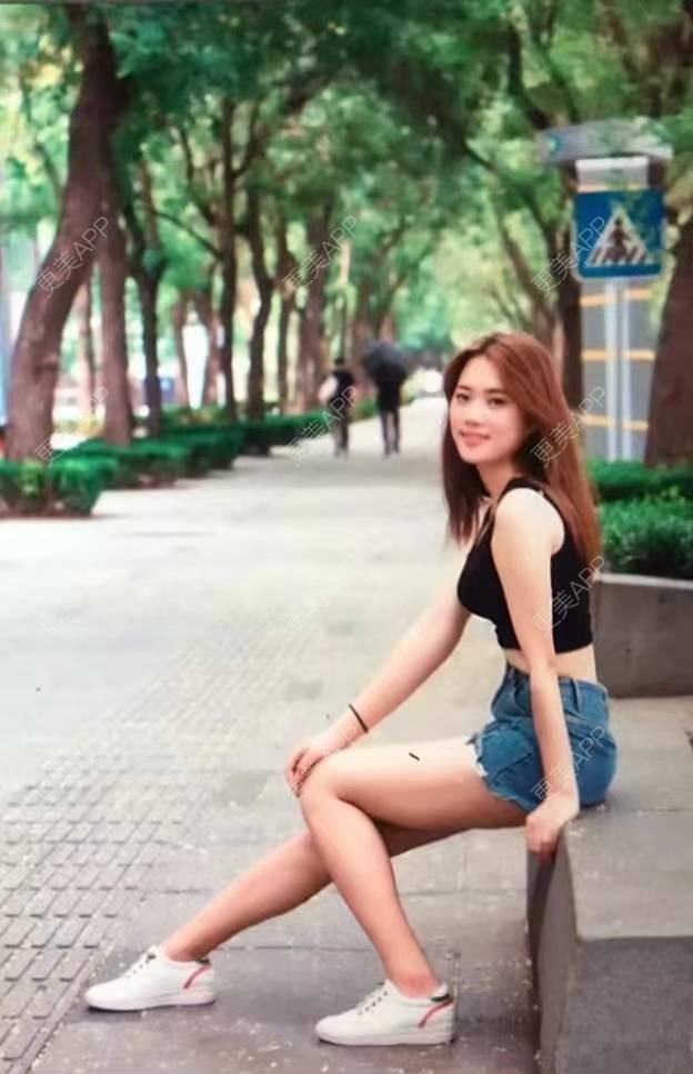 更美 - 等风啊熊抱啊的埋线提升经验 | 北京 | 埋线提升