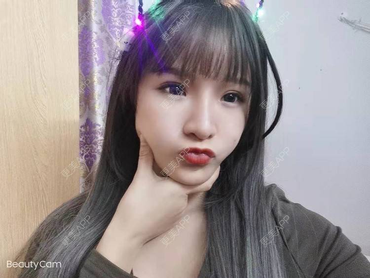 更美 - 更美用户dNhuhDESAX的唇综合经验 | 广州 | 视频日记 | 唇综合
