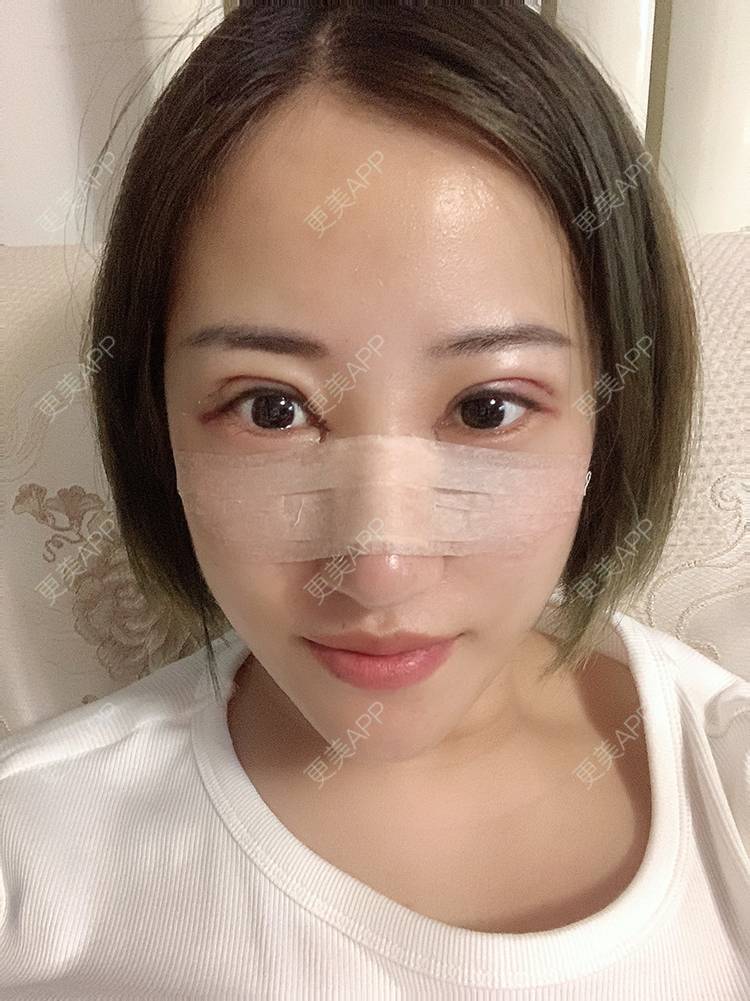 更美 - 泛舟湖心荷塘前。祭的眼部多项经验 | 北京 | 眼部多项