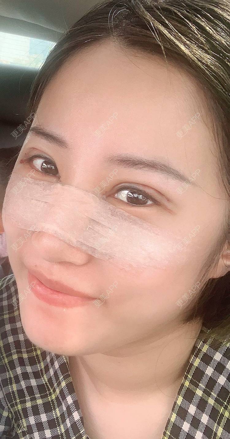 更美 - 泛舟湖心荷塘前。祭的眼部多项经验 | 北京 | 眼部多项