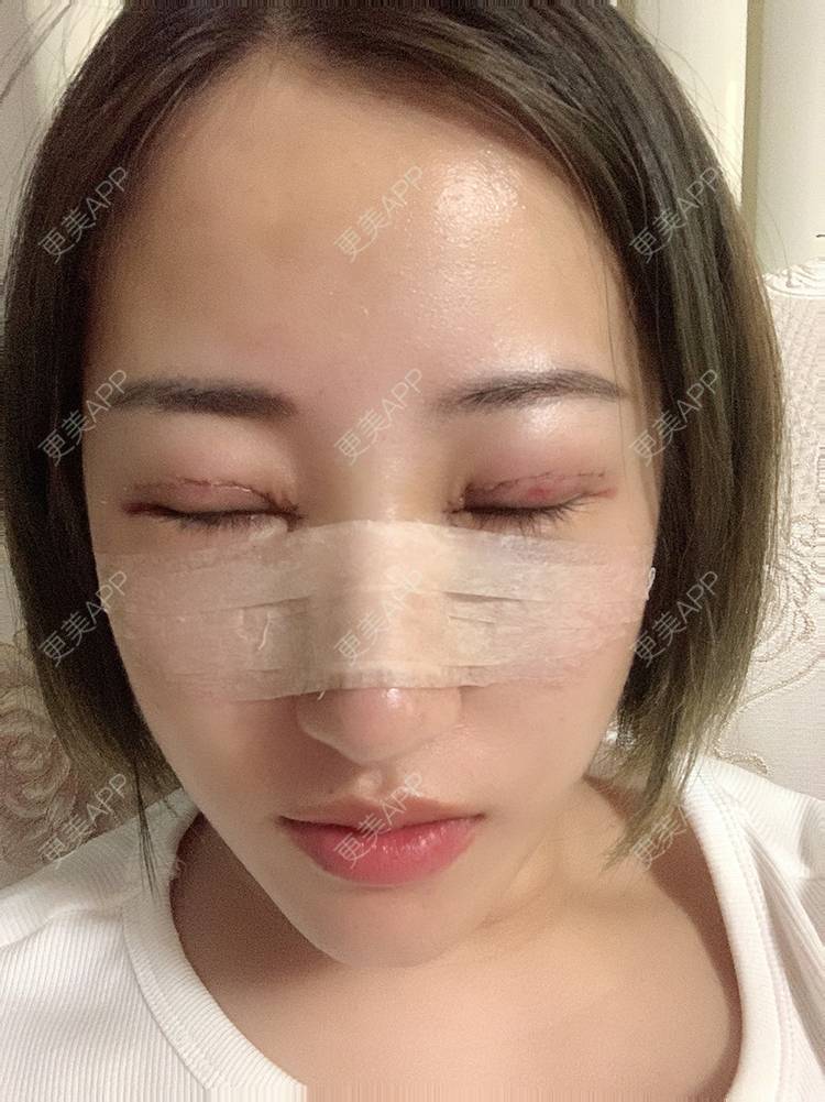 更美 - 泛舟湖心荷塘前。祭的眼部多项经验 | 北京 | 眼部多项