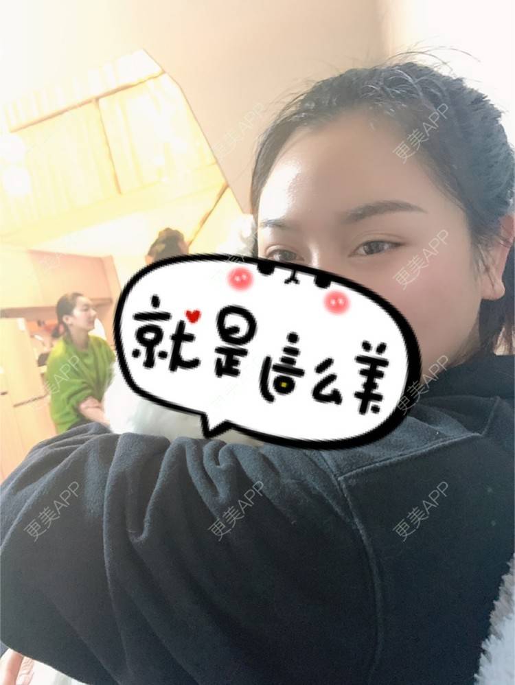 更美 - 更美用户XZl9FM68Hc的玻尿酸颈纹经验 | 玻尿酸颈纹 | 东莞