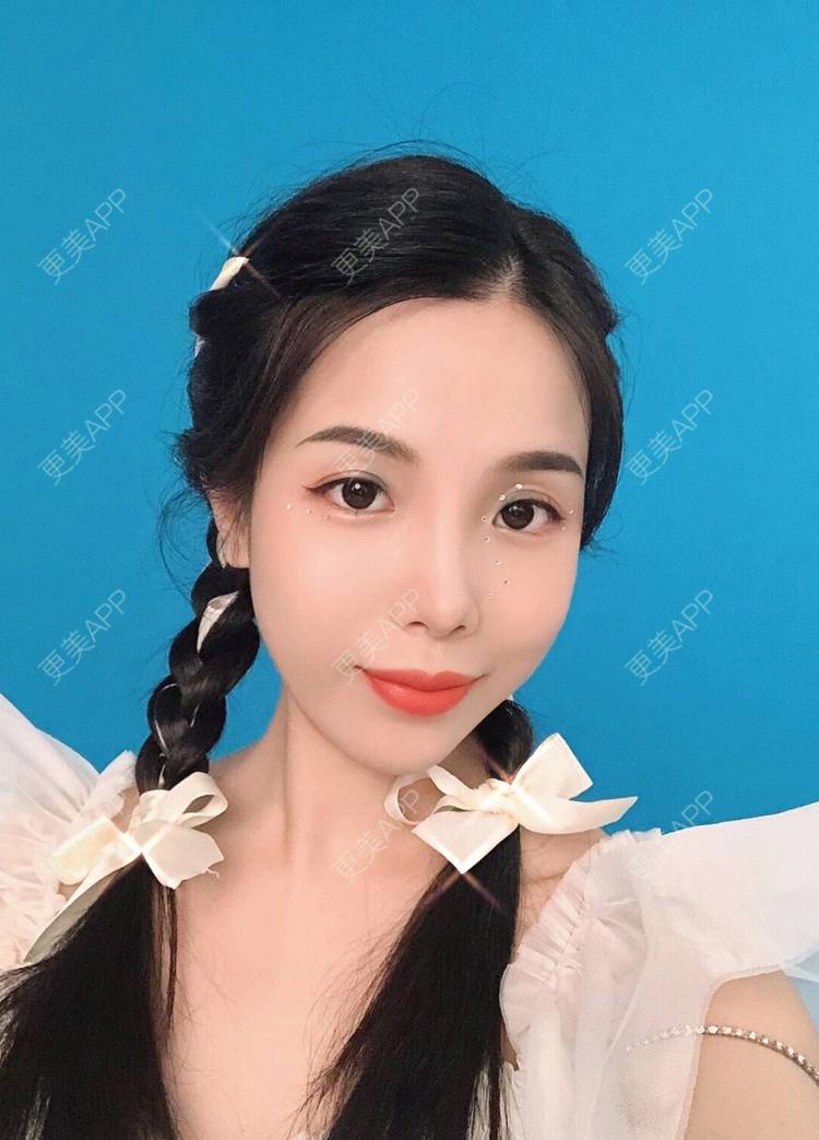 更美 - 更美用户R6T7237QNx的硅胶垫下巴经验 | 硅胶垫下巴 | 深圳