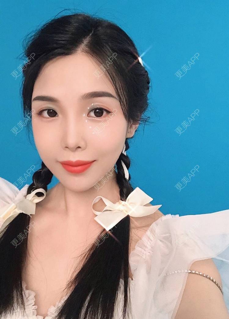 更美 - 更美用户R6T7237QNx的硅胶垫下巴经验 | 硅胶垫下巴 | 深圳