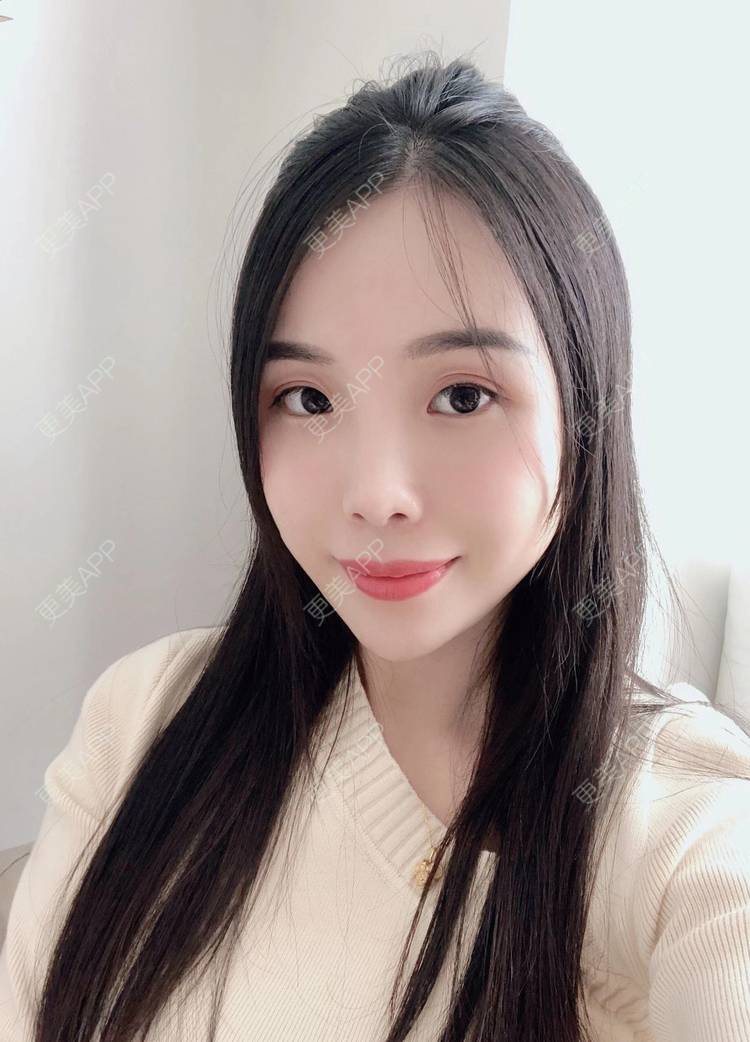 更美 - 更美用户R6T7237QNx的硅胶垫下巴经验 | 视频日记 | 硅胶垫下巴 | 深圳