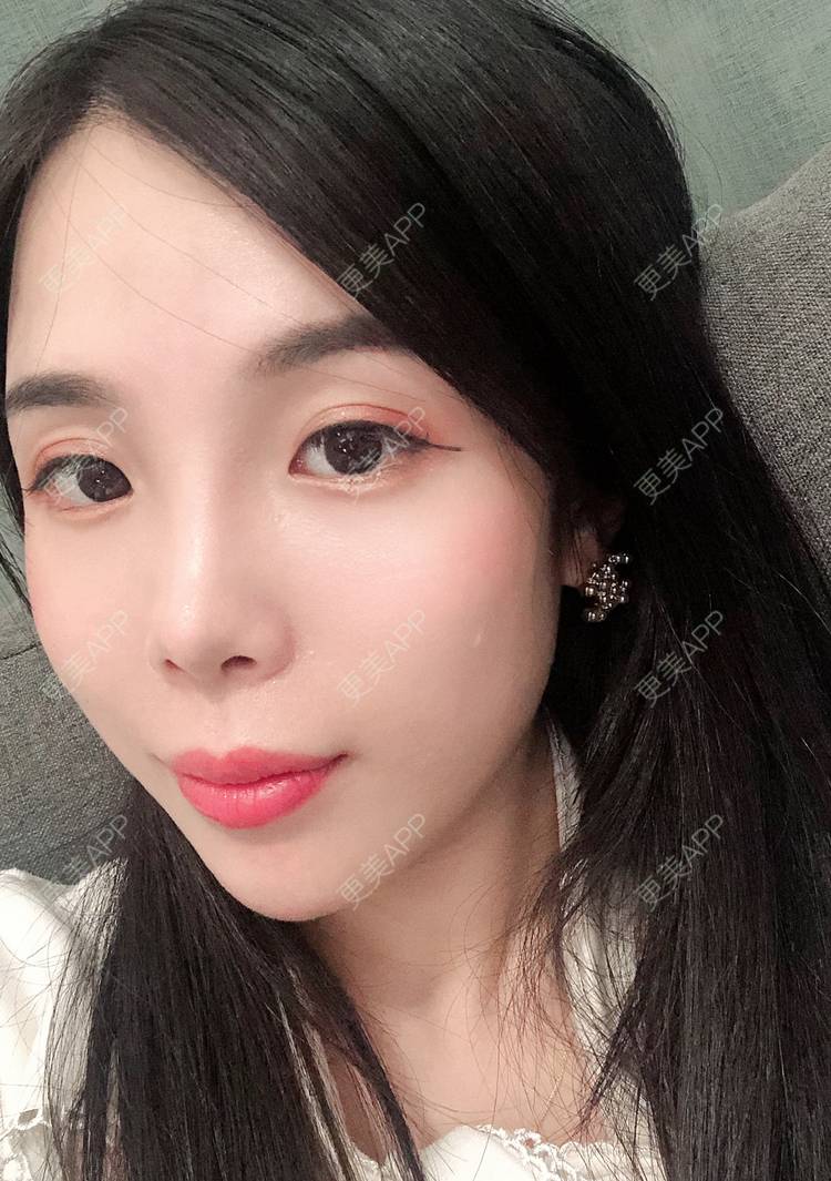 更美 - 更美用户R6T7237QNx的硅胶垫下巴经验 | 硅胶垫下巴 | 深圳