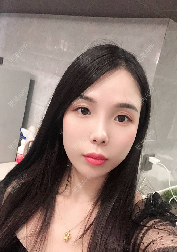 更美 - 更美用户R6T7237QNx的硅胶垫下巴经验 | 视频日记 | 硅胶垫下巴 | 深圳