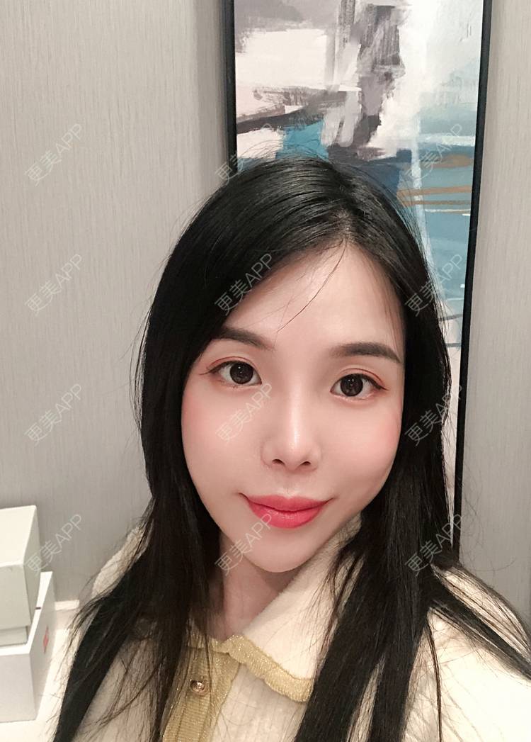 更美 - 更美用户R6T7237QNx的硅胶垫下巴经验 | 硅胶垫下巴 | 深圳