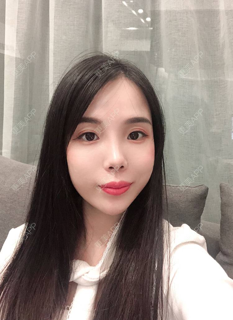 更美 - 更美用户R6T7237QNx的硅胶垫下巴经验 | 硅胶垫下巴 | 深圳