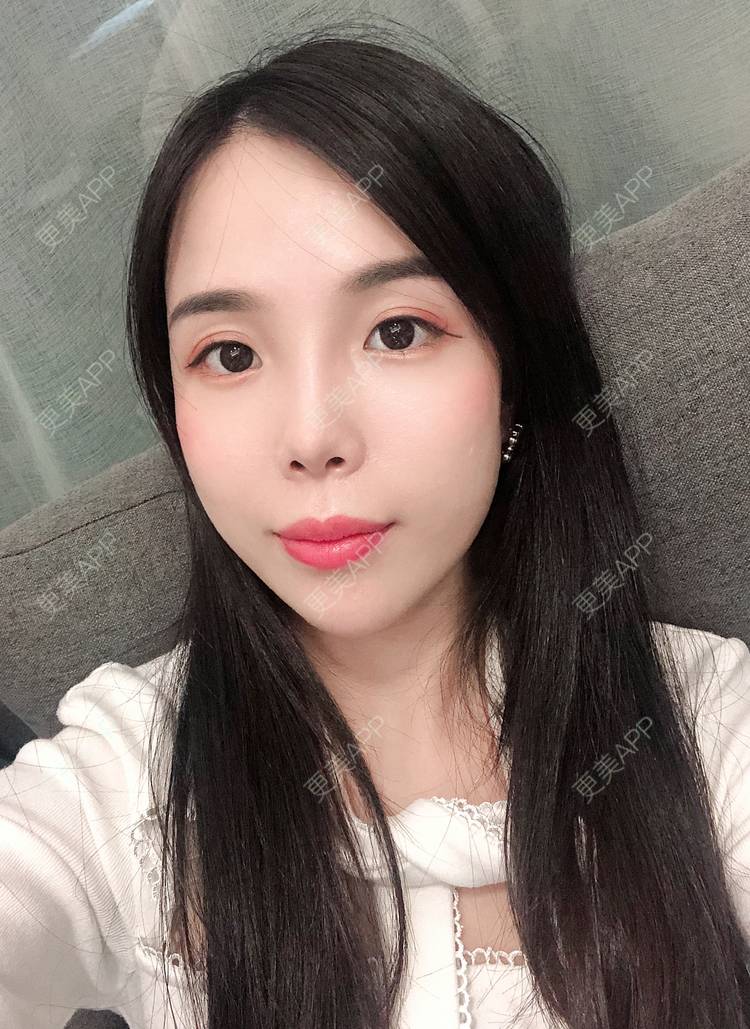 更美 - 更美用户R6T7237QNx的硅胶垫下巴经验 | 硅胶垫下巴 | 深圳
