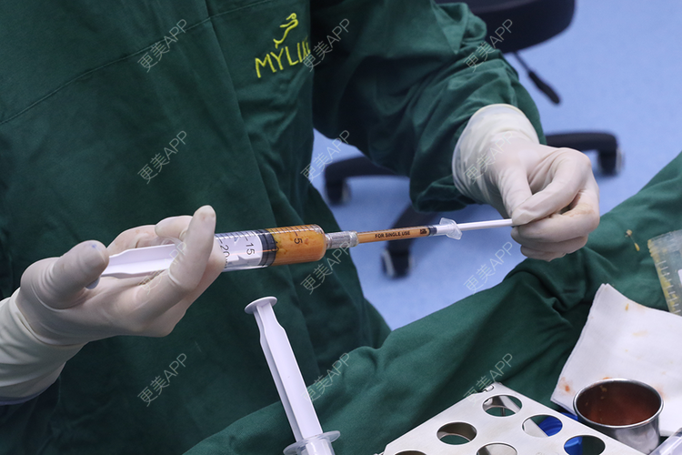更美 - 更美用户JKim6Dc5sv的吸脂瘦脸经验 | 吸脂瘦脸 | 射频溶脂瘦脸