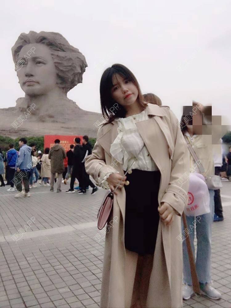 更美 - 左右逢源耶的吸脂瘦大腿经验 | 吸脂瘦大腿 | 小腿吸脂 | 手臂吸脂 | 深圳 | 腰部吸脂 | 腹部吸脂 | 吸脂