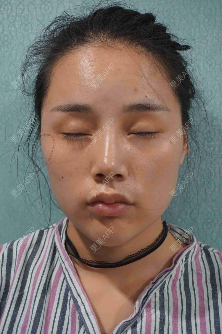 更美 - 网瘾少女一枚呀的眼部多项经验 | 眼部多项 | 视频日记 | 重庆