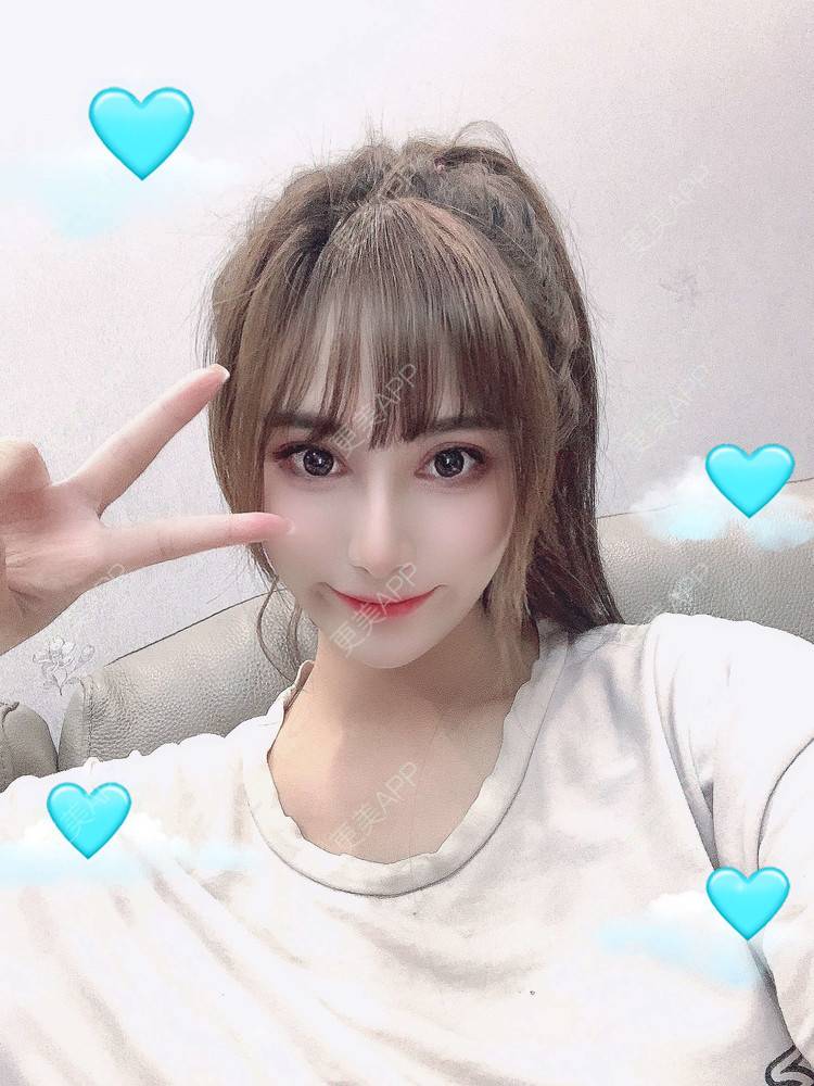 更美 - 小妹008的双眼皮经验 | 广州 | 视频日记 | 双眼皮