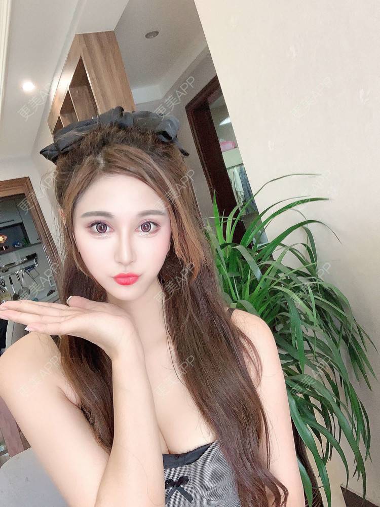 更美 - 小妹008的双眼皮经验 | 广州 | 视频日记 | 双眼皮