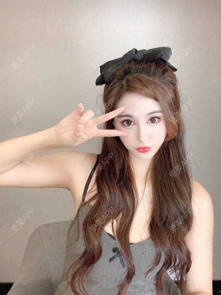 更美 - 小妹008的双眼皮经验 | 广州 | 视频日记 | 双眼皮