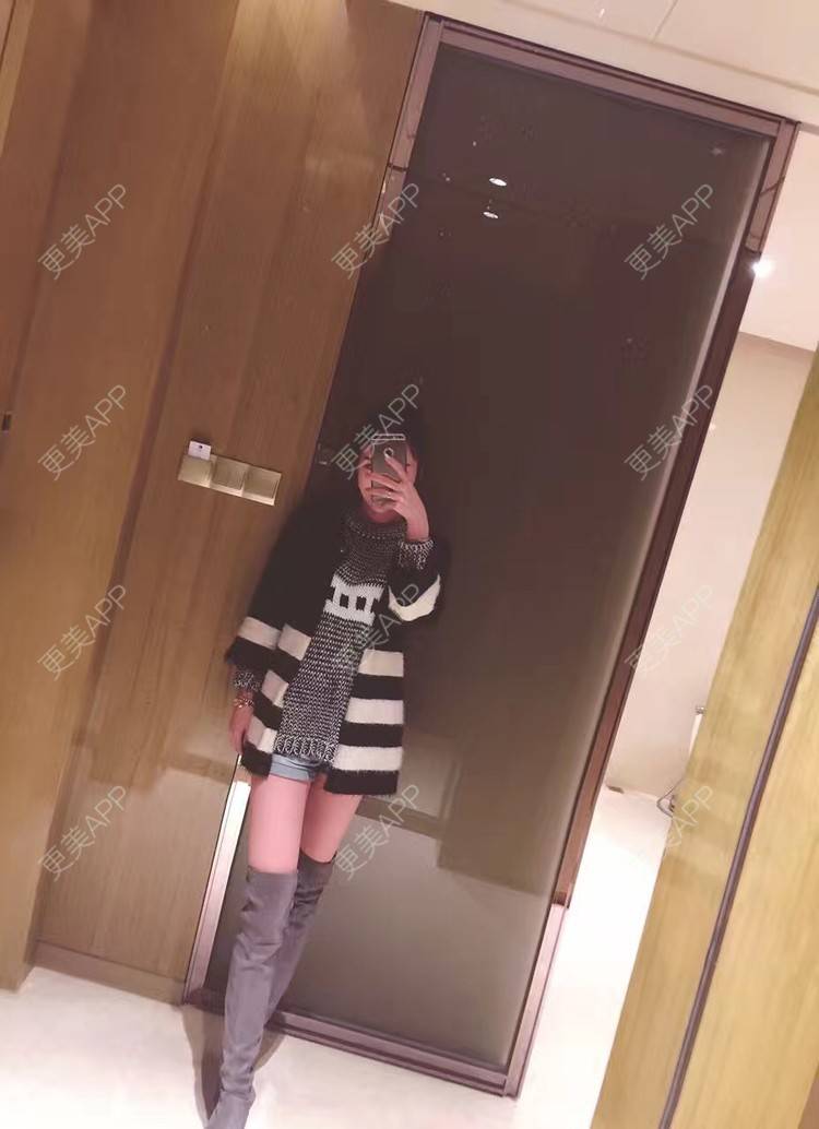 更美 - 尼泊尔的海的背部吸脂经验 | 背部吸脂 | 吸脂瘦大腿 | 小腿吸脂 | 手臂吸脂 | 吸脂 | 深圳