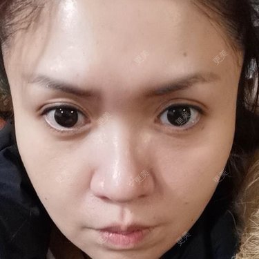 更美用户kCoa2g8DUn