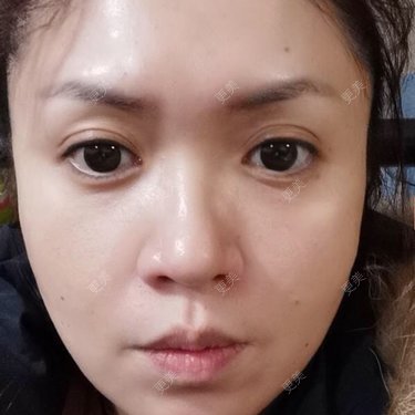 更美用户kCoa2g8DUn