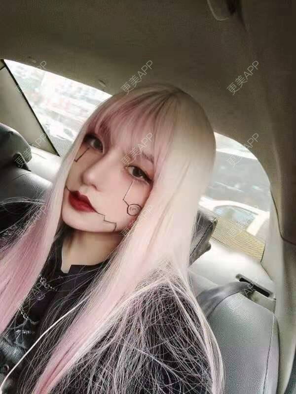 更美 - 谢哒双的鼻部多项经验 | 耳软骨隆鼻 | 鼻翼缩小 | 自体软骨垫鼻尖 | 鼻孔矫正 | 鼻部多项 | 肋软骨隆鼻 | 重庆 | 鼻中隔软骨隆鼻 | 鼻小柱延长