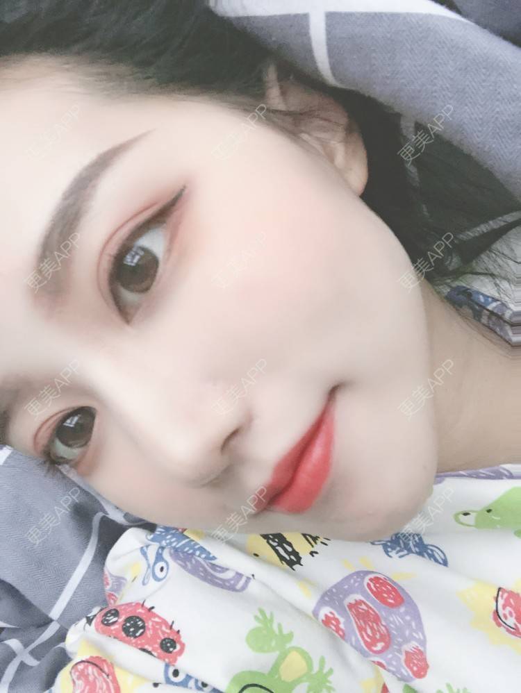 更美 - 更美用户gTfbaSPG8z的硅胶垫下巴经验 | 硅胶垫下巴 | 长沙