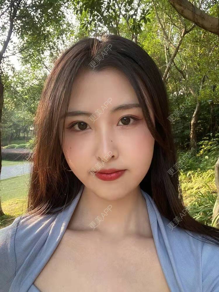 更美 - 温茹暖风的自体脂肪填充泪沟经验 | 自体脂肪填充泪沟