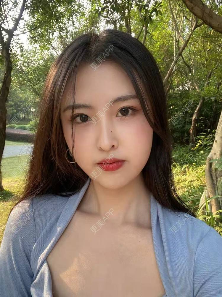 更美 - 温茹暖风的自体脂肪填充泪沟经验 | 自体脂肪填充泪沟
