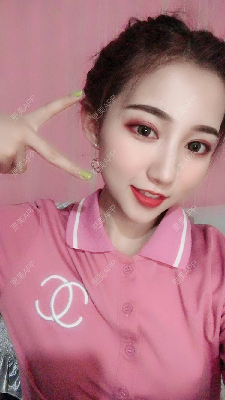 更美 - 更美用户gTfbaSPG8z的硅胶垫下巴经验 | 硅胶垫下巴 | 长沙 | 自体脂肪全面部填充 | 自体脂肪面部填充