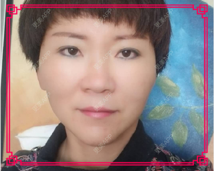 更美 - 更美用户issoWkJiGy的拉皮经验 | 白银 | 拉皮