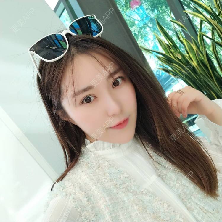 更美 - 更美用户TIxx2z1nYV的埋线双眼皮经验 | 埋线双眼皮 | 郑州