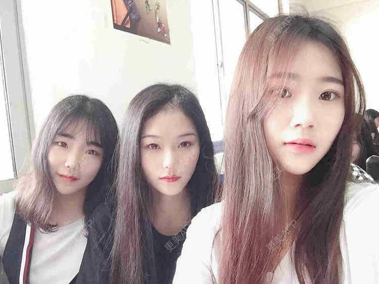 更美 - 。╃颓喃尐女渭的颧弓降低经验 | 颧弓降低 | 武汉
