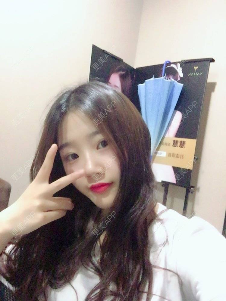 更美 - 。╃颓喃尐女渭的颧弓降低经验 | 颧弓降低 | 武汉
