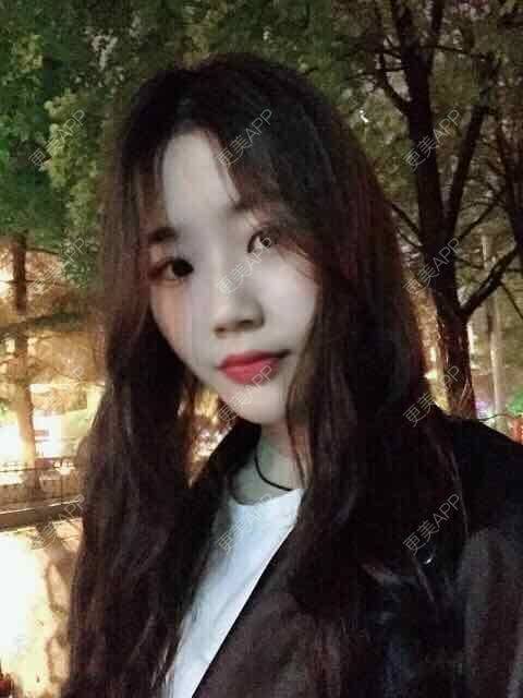 更美 - 。╃颓喃尐女渭的颧弓降低经验 | 颧弓降低 | 武汉