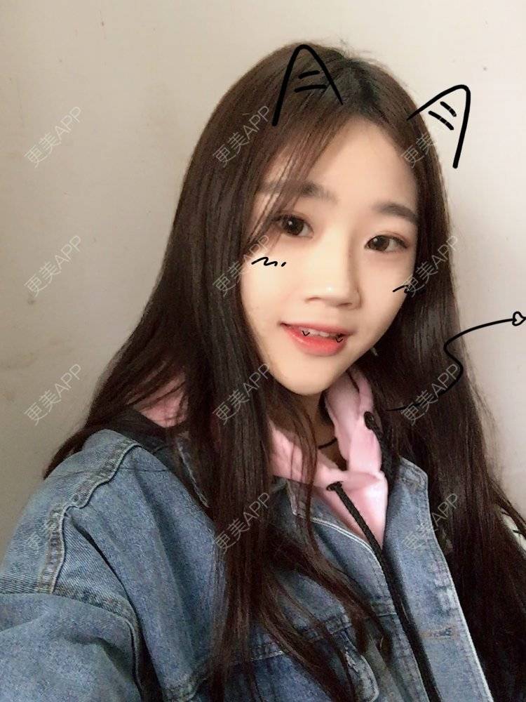 更美 - 。╃颓喃尐女渭的颧弓降低经验 | 颧弓降低 | 武汉