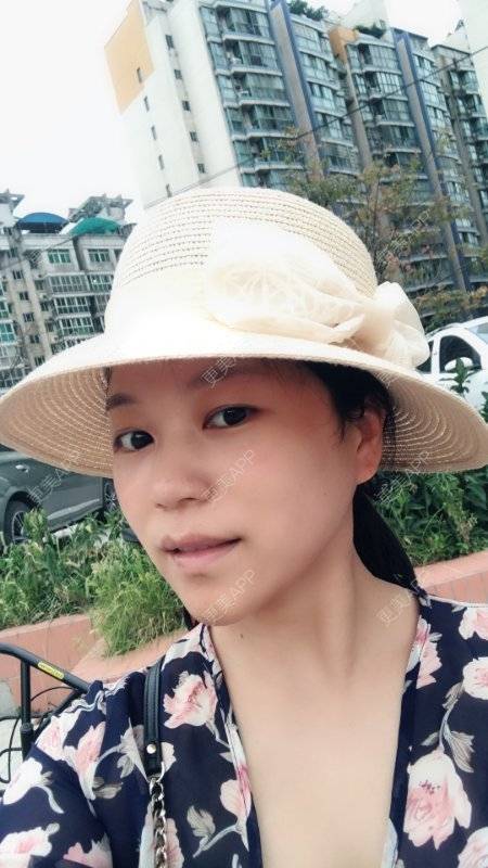 更美 - 更美用户1DnFWuIju7的埋线提升经验 | 埋线提升 | 视频日记 | 埋线除皱